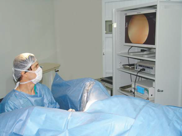 Endoscopia Ginecológica